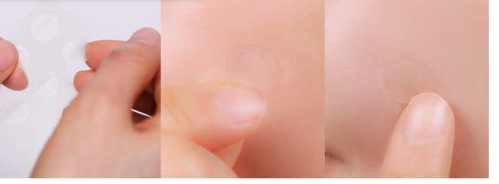 [Neogen] A-CLEAR AID SOOTHING SPOT PATCH - glass skin.